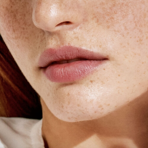 Natuurlijk resultaat van een lipbehandeling